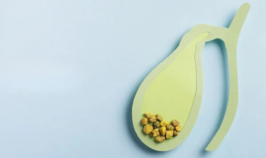 gallbladder stones and mounjaro